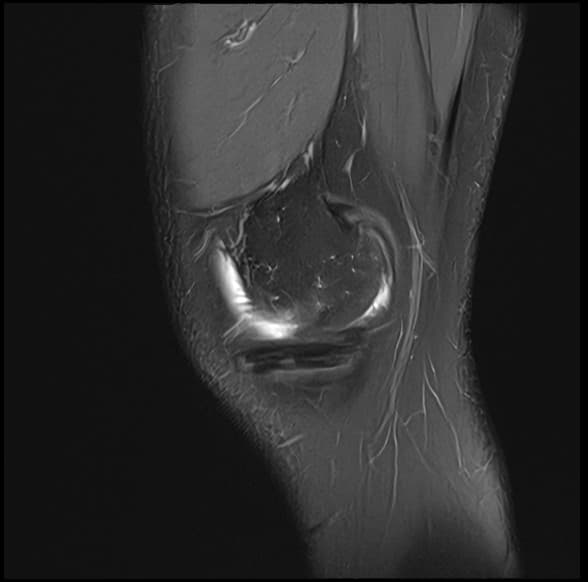 Sagittal knee MRI rendered in your browser